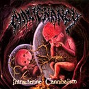 Intrauterine Cannibalism