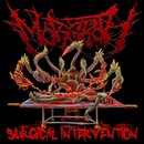 Surgical Intervention