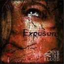 Exposure